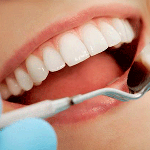 Ortodontinis gydymas, dantų tiesininimas